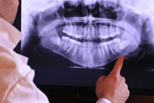 Best Chipped Tooth Repair Near Me  in Oakleaf Plantation, FL
